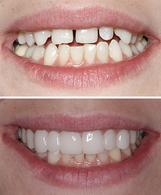 delka-before-after