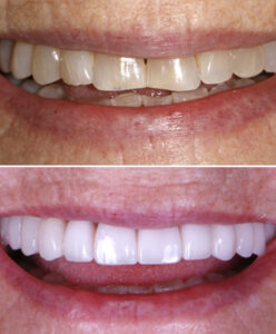 Before and After Treatment